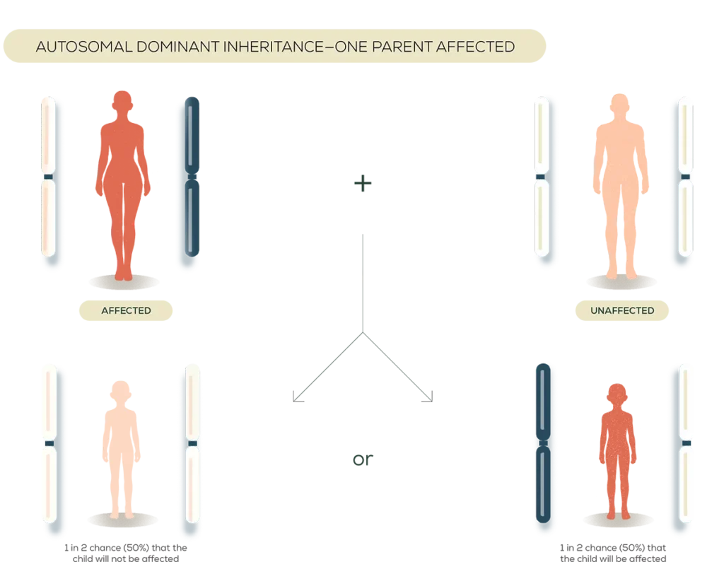 Illustration showing a new genetic variant occurring for the first time in an individual without a family history.